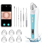 Amazon.com: Blackhead Remover Vacuum, USB Interface Type Pore
